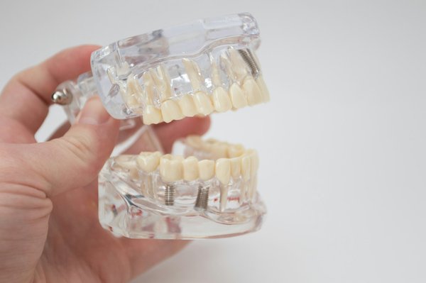 Remèdes et astuces pour adoucir une mâchoire carrée